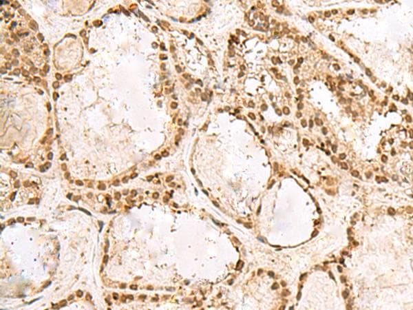 Polyclonal Rabbit anti-Human KRR1 Antibody (IHC)
