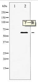 Polyclonal Rabbit anti-Human PDPK1 / PDK1 Antibody (IHC, WB)