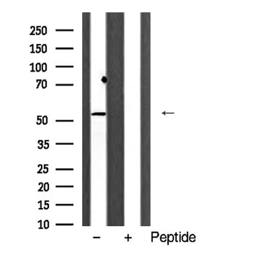 ACVR1B / ALK4 Antibody