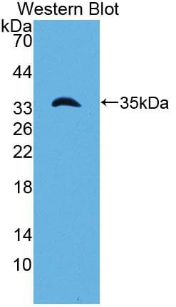 LAMC1 / Laminin Gamma 1 Antibody (aa1283-1551)