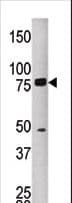 Polyclonal Rabbit anti-Human MELK Antibody (aa525-554, WB)