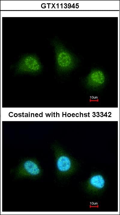 PADI4 / PAD4 Antibody (aa326-611)