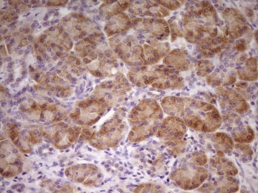 TNFRSF10B / Killer / DR5 Antibody (aa203-411, clone OTI1B9)