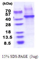 Human CD14 Protein (Recombinant His)
