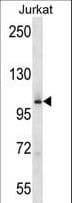 GCK / Germinal Center Kinase Antibody (aa321-349)
