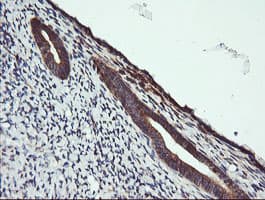 Monoclonal Mouse anti-Human MAP2K1 / MKK1 / MEK1 Antibody (clone OTI1A9, IHC, IF, WB)