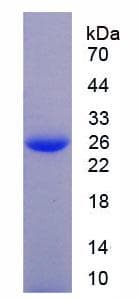 Human CLIC1 / NCC27 Protein (Recombinant His-T7)