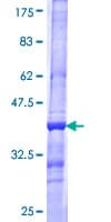Human SLC6A19 Protein (Recombinant GST, N-terminus)