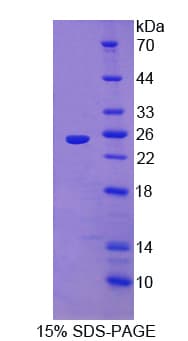 Human IL1RAPL1 Protein (Recombinant His)