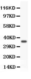 Polyclonal Rabbit anti-Human FOXM1 Antibody (aa411-763, WB)