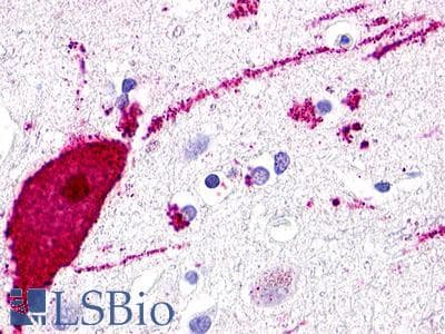 PathPlus™ Polyclonal Rabbit anti-Human GPR119 Antibody (Cytoplasmic Domain, IHC)