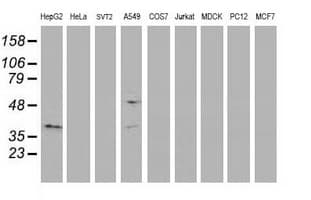 MAPRE2 / EB2 Antibody (clone OTI1B10)