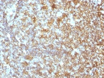 CD45 / LCA Antibody (clone SPM496)