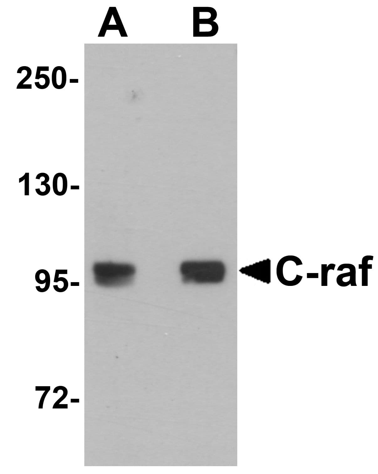 RAF1 / RAF Antibody