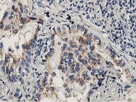 LACTB2 Antibody (clone OTI1A8)
