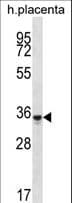 OR6K6 Antibody (aa310-338)