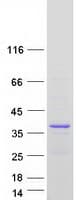 Human FAM110A Protein (Recombinant Myc-DDK (Flag))