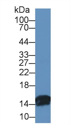 I-FABP / FABP2 Antibody (aa2-128)
