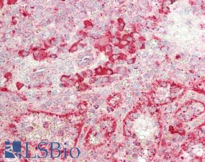 GUSB / Beta Glucuronidase Antibody (aa451-649)
