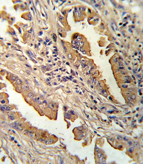 Polyclonal Rabbit anti-Human IL8 / Interleukin 8 Antibody (aa72-99, IHC, IF, WB)