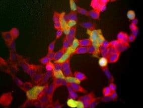 Polyclonal Rabbit anti-Human ENO2 / NSE Antibody (IF, WB)