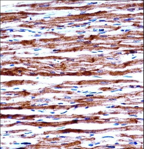 POLR2J Antibody (aa89-117)