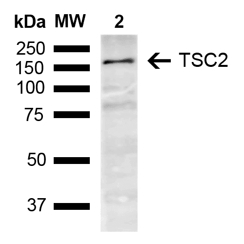 Tuberin / TSC2 Antibody (Biotin)