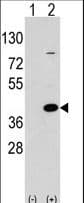 EPM2A / Laforin Antibody (aa288-317)