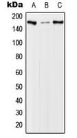 Polyclonal Rabbit anti-Human EGFR Antibody (phospho-Thr678, WB)