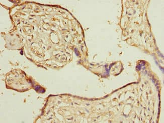 CALU / Calumenin Antibody