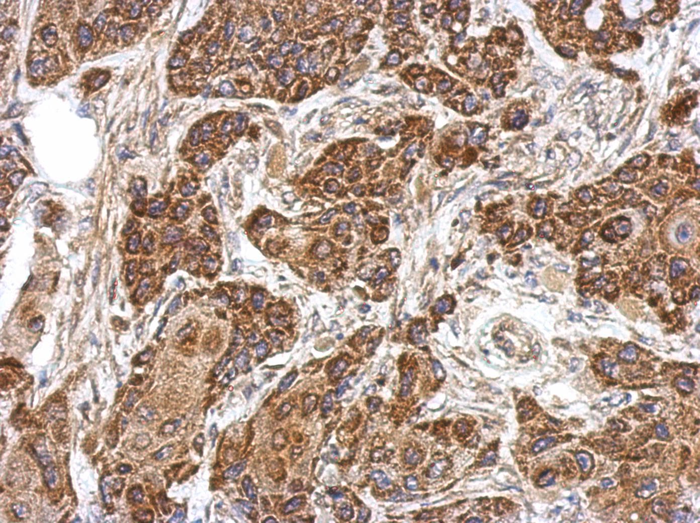 ME1 / Malate Dehydrogenase Antibody (aa161-519)