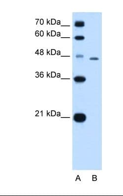 TAPBP / Tapasin Antibody (aa307-356)