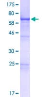 Human VPS37A Protein (Recombinant GST)