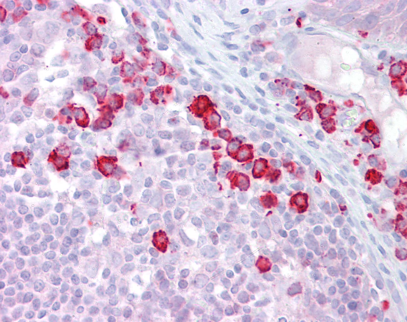 Polyclonal Rabbit anti-Human TKFC / DAK Antibody (N-Terminus, IHC, WB)