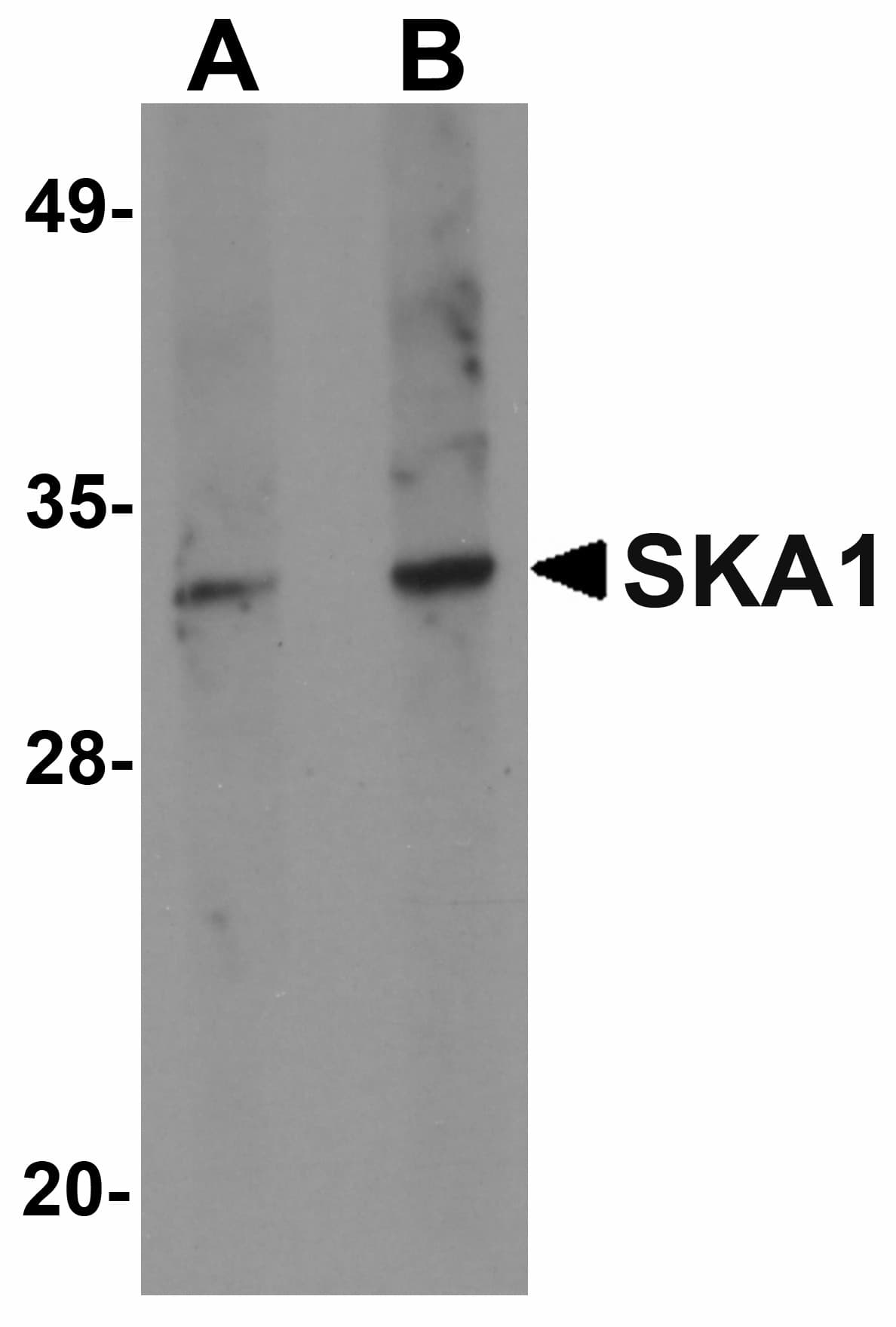 IHC-plus™ SKA1 Antibody