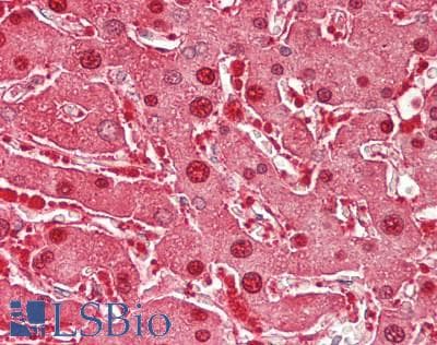 PathPlus™ ARG1 / Arginase 1 Antibody (clone 4E6)
