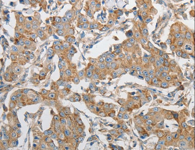 PRMT5 Antibody