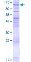Human SLC7A14 Protein (Recombinant GST)