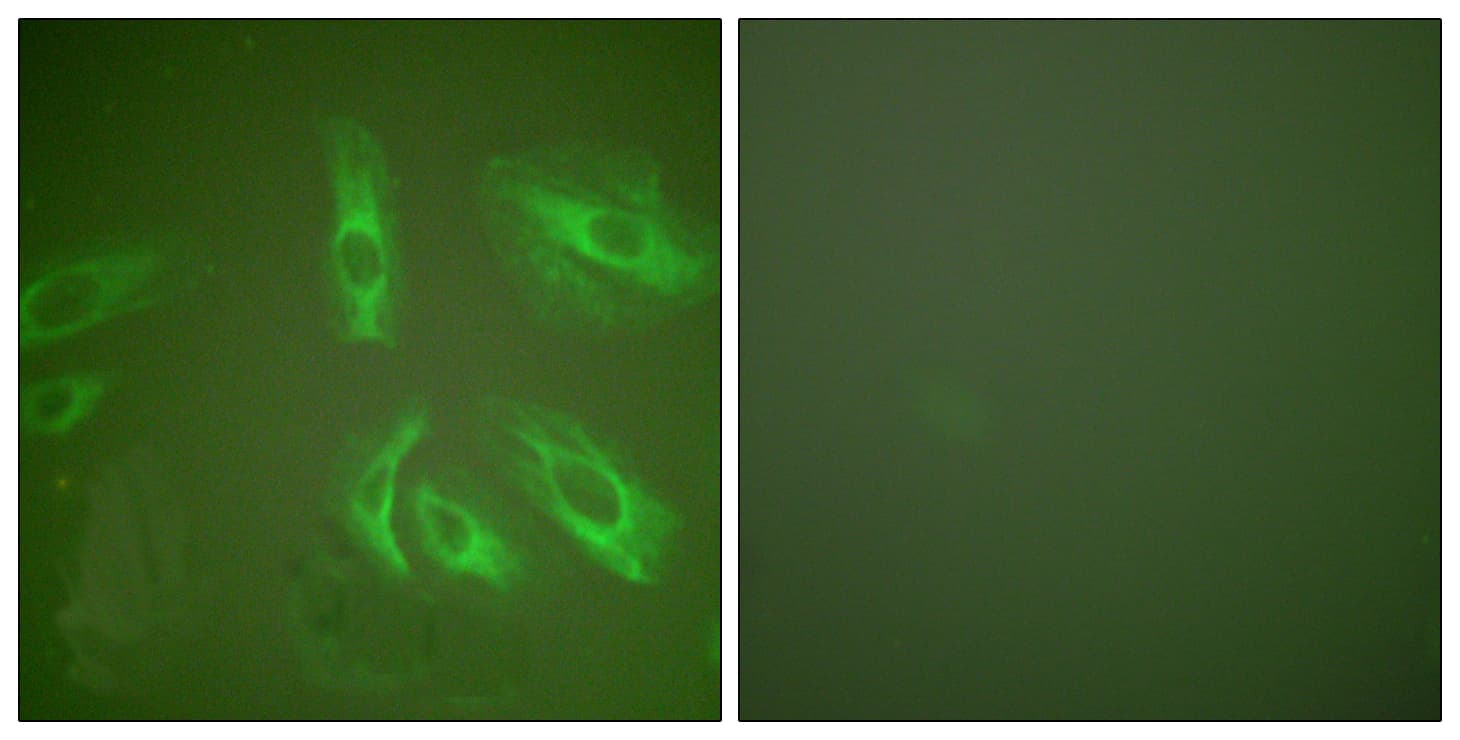 Gastrin Antibody (aa52-101)