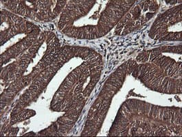 DNM1L / DRP1 Antibody (clone OTI1C1, Carrier-free)