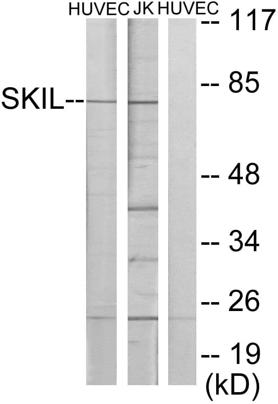 SKIL / SNO / SnoN Antibody (aa616-665)
