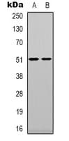 TPH1 / Tryptophan Hydroxylase Antibody (N-Terminus)