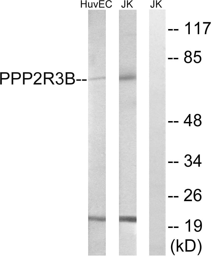 IHC-plus™ Polyclonal Rabbit anti-Human PPP2R5D Antibody (aa544-593, IHC, WB)