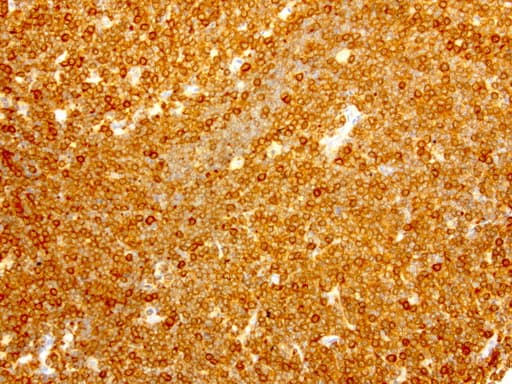 NME1 / NM23 Antibody (clone UMAB94)