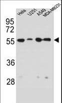 IHC-plus™ Polyclonal Rabbit anti-Human Vimentin Antibody (IHC, IF, WB)