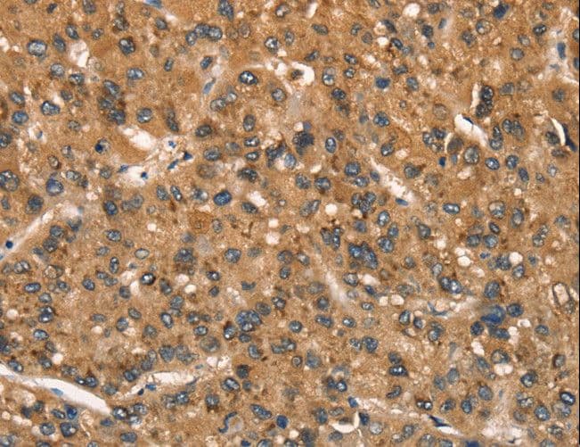 CSTB / Cystatin B / Stefin B Antibody