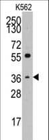 THPO / TPO / Thrombopoietin Antibody (aa300-329)