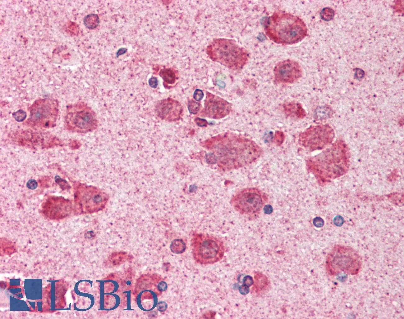 KIF5C Antibody (N-Terminus)
