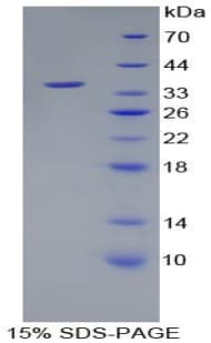 Human WNT10B Protein (Recombinant His-T7)