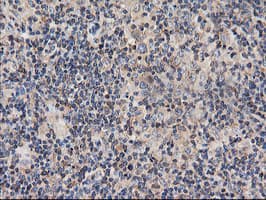 TUBAL3 Antibody (clone OTI4D8)